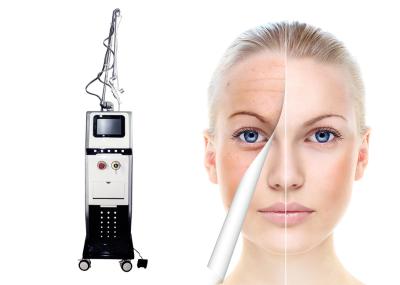 laser fracionário do CO2 para cicatrizes da acne