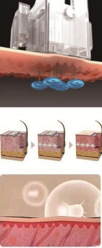 Skin Beauty Water Mesotherapy Machine for Vacuum Hyaluronic Acid Injection