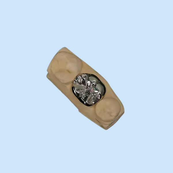 Продолжительное зубоврачебных Dentures кроны литейного металла лаборатории FMC полных высокопрочное