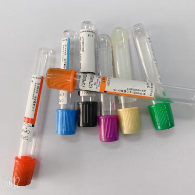 Tubo de análise de sangue da concentração alta PRP com o gel do ACD da elevação fácil de usar