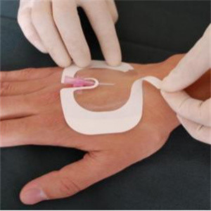 пусковые площадки 5*6cm водоустойчивые прозрачные одевая стерильные слипчивые для ран