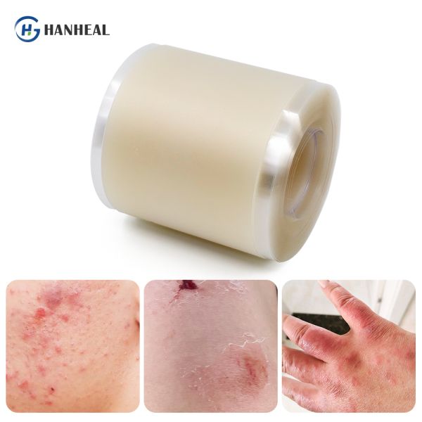 Self Adhesive Hydrocolloid Wound Dressing Bandages Roll for Blister Prevention 5cmx5m