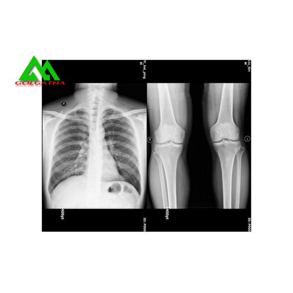 High Sensitivity Medical X Ray Film X Ray Room Equipment Accessories All Size