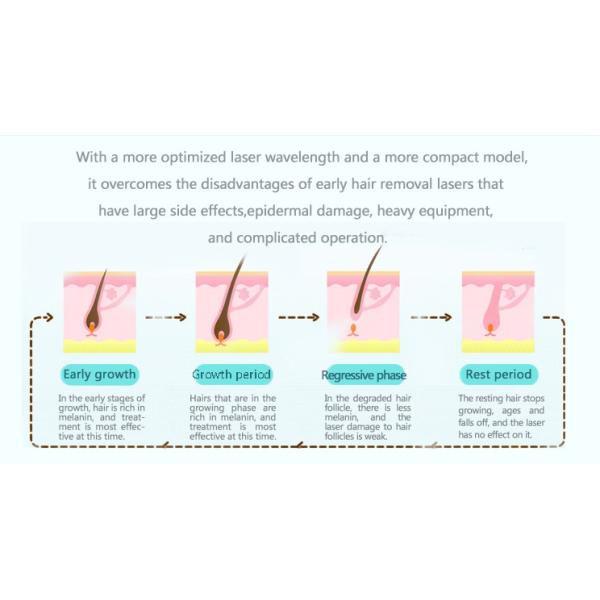 GOMECY 755NM 808NM 1064NM Fiber laser hair removal machine