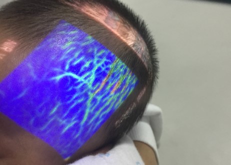 Vena de alta resolución de los pacientes obesos que localiza el infrarrojo del dispositivo para Venipuncture