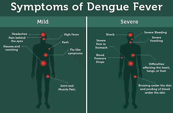 Одобренная КЭ кассета теста антитела набора теста антигена лихорадкаи Нс1 быстрая