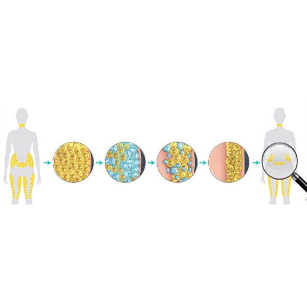 2018 latest Cryolipolysi Cool Shape machine Fat loss Cryolipolysis fat freezing machine Germany