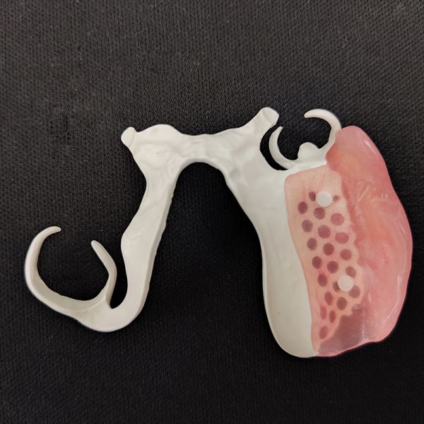 Peek Material Removable Dentures Customized 3D Laser Printing for Natural Fit