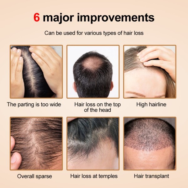 Wireless 97pcs LED Anti Hair Loss Scalp Treatment 850nm 660nm Red Light Hair Growth Cap