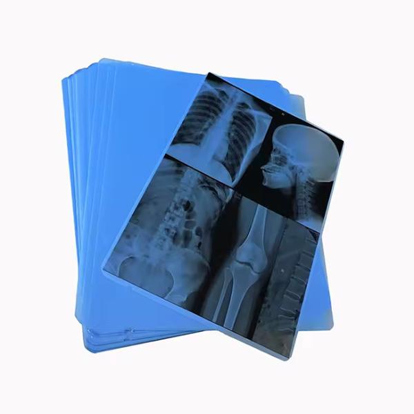 Industry Leading Production Our Professionally Produced Medical Blue X - Ray Film For Laser Printing Is The Go - To Choice.