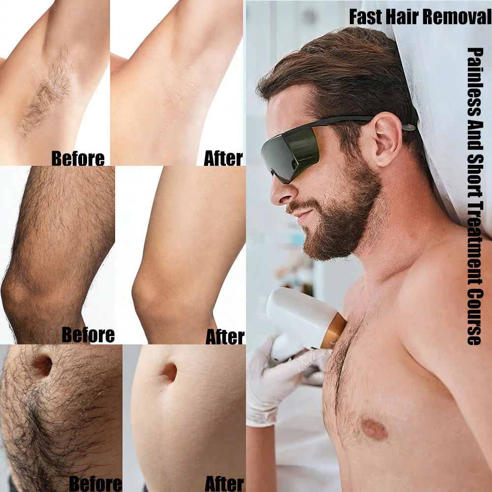 Sapphire Laser Hair Removal Machine 1200W 2400W Triple Wavelength With 12 Inch Touch Screen