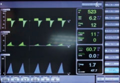 Оборудования вентилятора S1100 20 CmH2O-100 CmH2O машина медицинского дыша в ICU