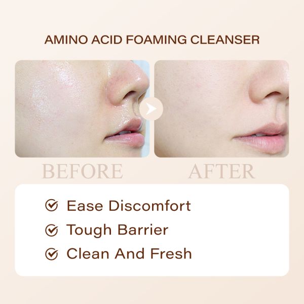 Niacinamide Foam Cleanser Whitening Anti-acne Face Wash Cosmetic Skin Care Oil Control Amino Acid Firming Cleanser