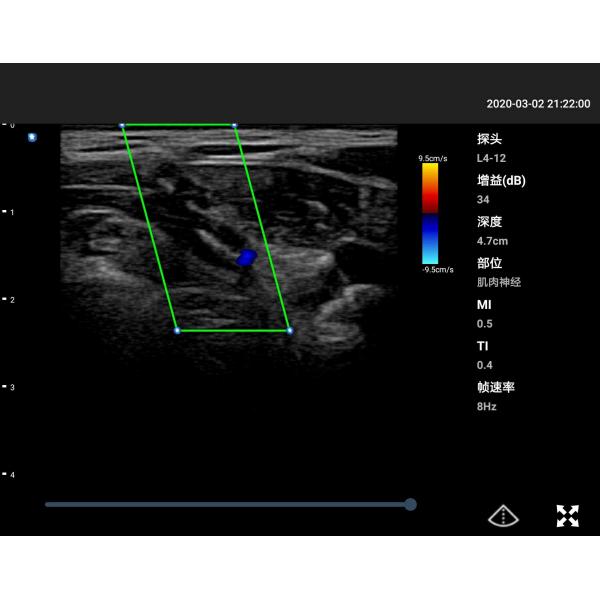 CE Diagnosis And Treatment Home Ultrasound Scanner Mobile 8.3MHz