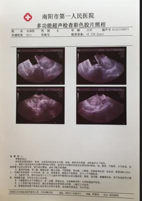 Single Side Printing 0.10Mm Laser X Ray Film For Hospital