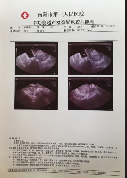 CE PET Based Inkjet Priting White A4 Medical Inkjet Dry Film