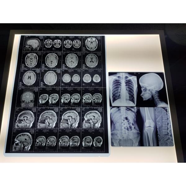 El ANIMAL DOMÉSTICO impermeable de 215 micrones basó X médico Ray Film