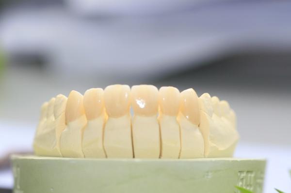 Great Biocompatibility Full Contour Zirconia Dental Crown For Dental Laboratory