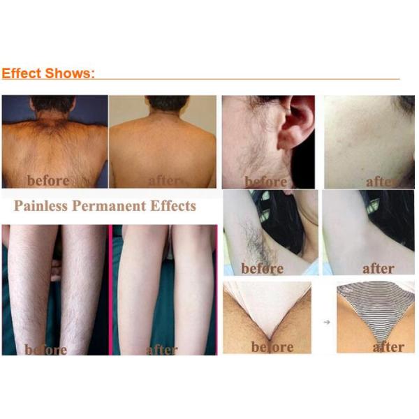 Professional Painless SHR IPL Hair Removal Machine With 2 Handpieces