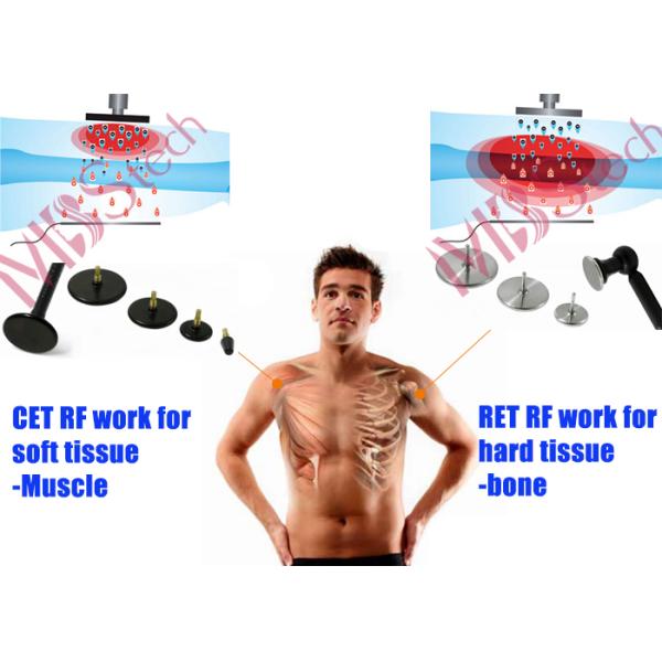 0.5Mhz Physios Pain Relief RET CET Tecar Therapy Machine