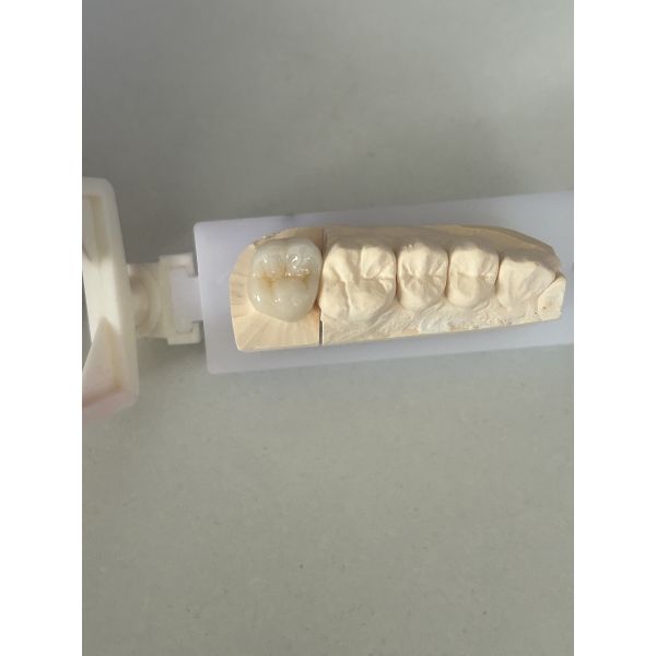 High Strength 1200 MPa Zirconia Crown with Excellent Biocompatibility and Long-lasting Durability for Dental Restoration