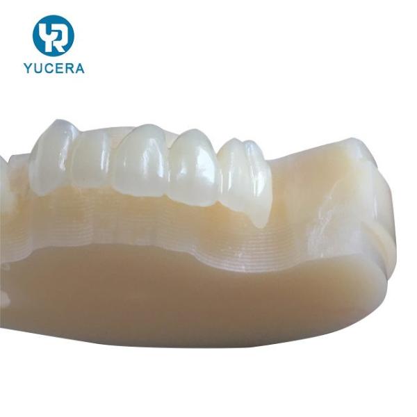 Fratura dental dos discos Multilayer de PMMA resistente para restaurações provisórias