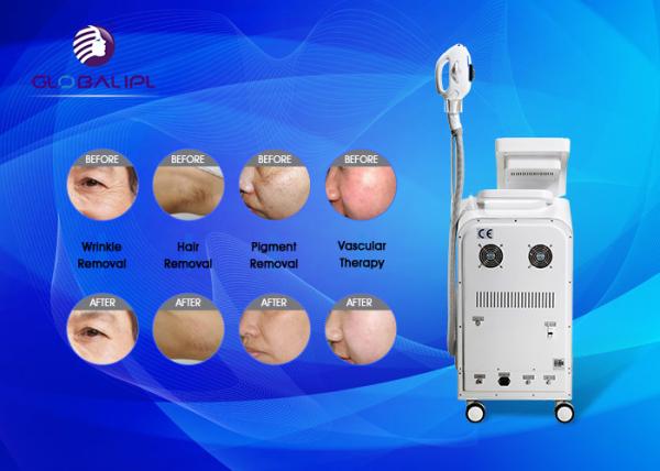 Máquina Multifunction leve US002H da beleza do IPL YAG RF E para a remoção da tatuagem
