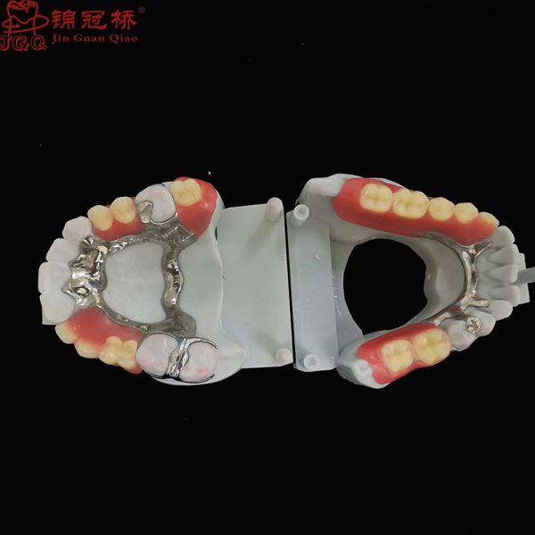 Co Cr Alloy Removable Dentures DSD Aesthetic Design Acrylic Dentures Customized