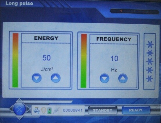 1064nm Long Pulse nd yag laser machine for lip , armpit , arms , legs Hair Removal