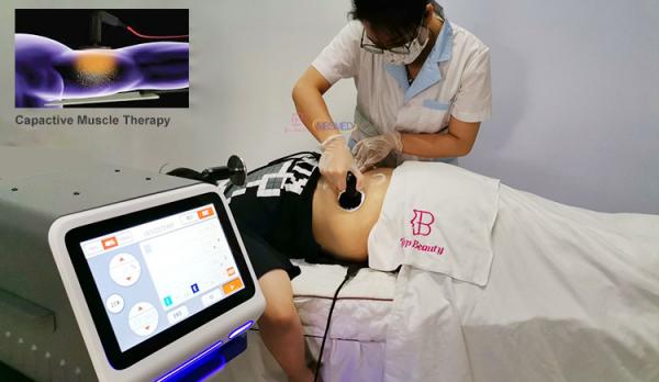 Winback Tecar Terapia Fisioterapia Humana 448khz Indiba alívio da dor nas costas