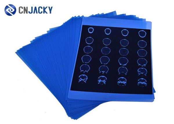 Medical Thermal Dry Printer 16K Fuji X Ray Film