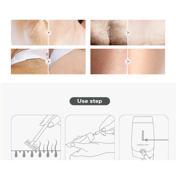 Portable Permanent Hair Removal Laser Machine
