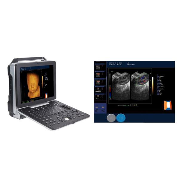 Portable 3D 4D Real Time Color Doppler Ultrasound Scanner Multi Function