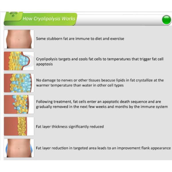 Non Surgical Liposuction Cryolipolysis Body Slimming Machine , Vacuum Weight Loss Machine