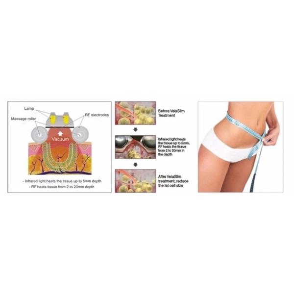 Rf Cavitation sous vide Body Slimming Machine de beauté Utilisation dans les salons