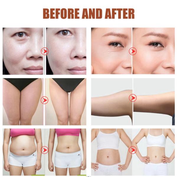 Factory Price Wholesale OEM ODM 6 In 1 40K vacuum cavitation system Radio Frequency Slimming Beauty machine
