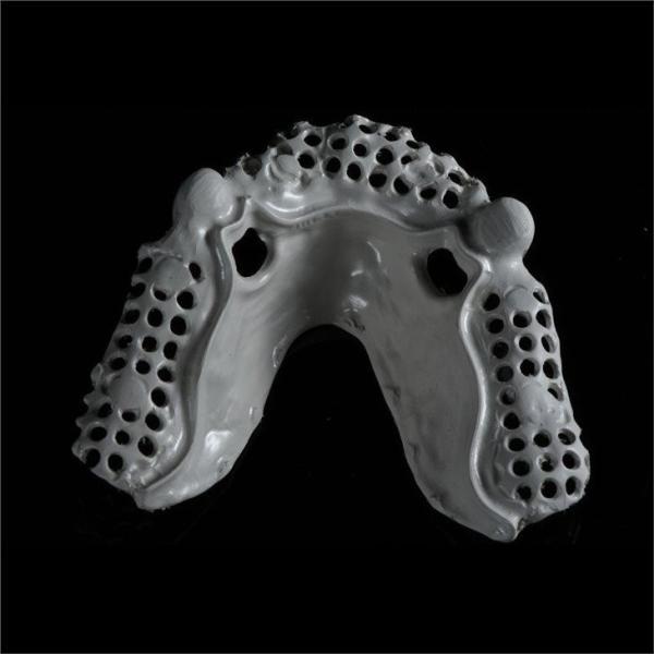 Removable Telescopic Partial Denture China Dental Lab For Missing Teeth