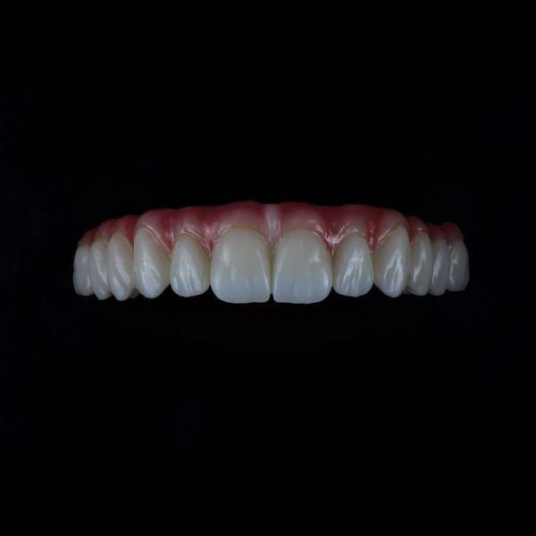 Full Coutour Arch Zirconia Fixed Dentures Crown Biocompatible Material
