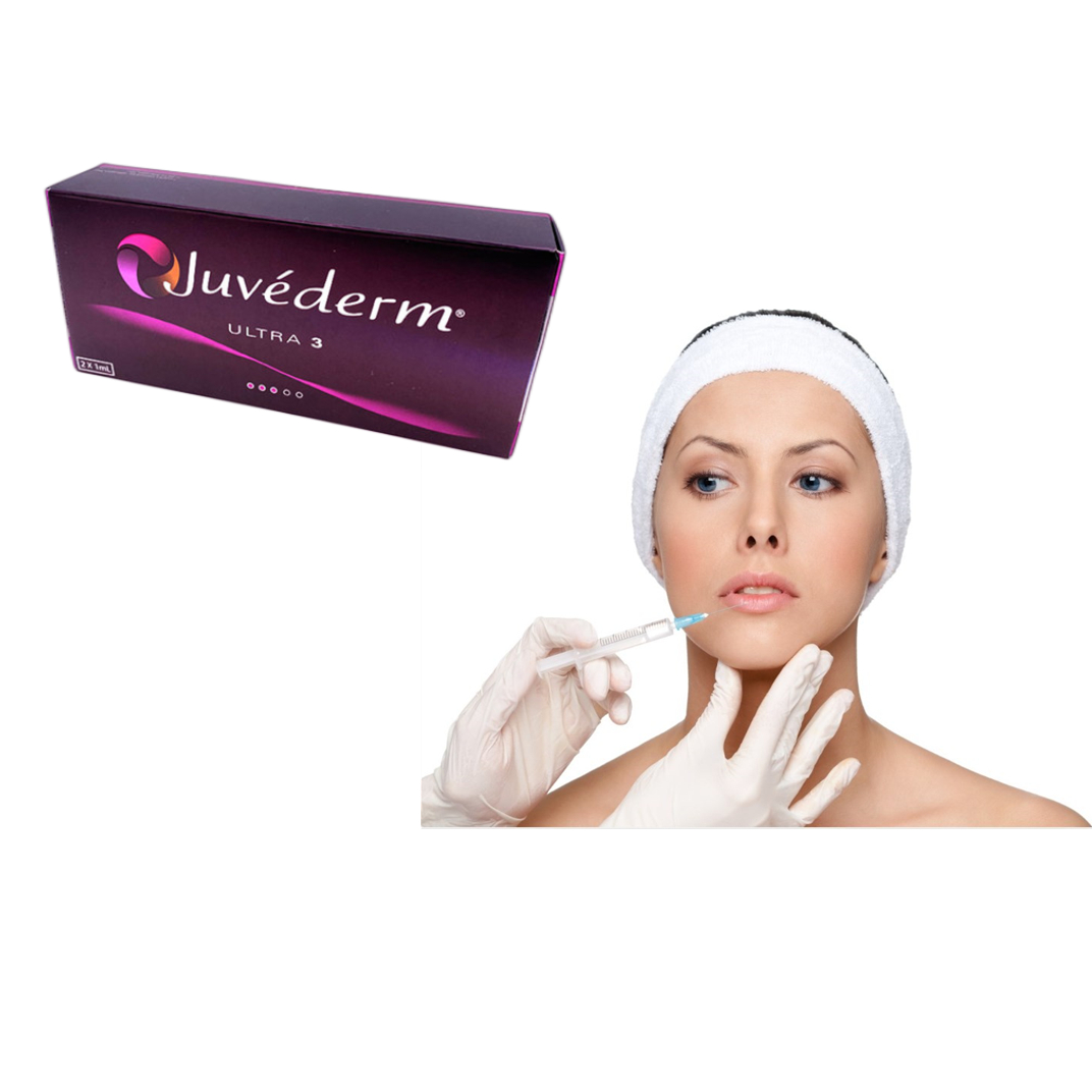 Hyaluronic кисловочный дермальный заполнитель Juvederm ультра 3 губы стороны