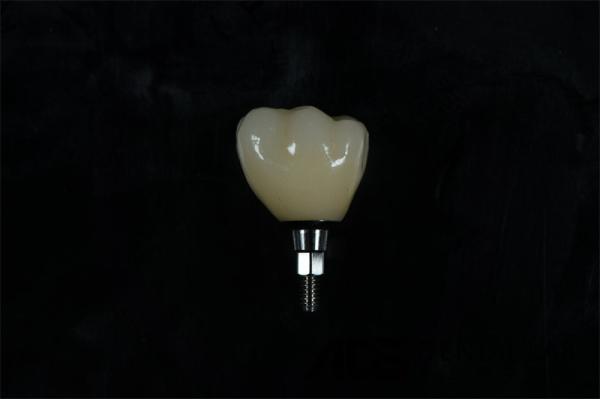 Cylindrical Titanium Zirconia Screw Retained Dental Implant Natural Looking
