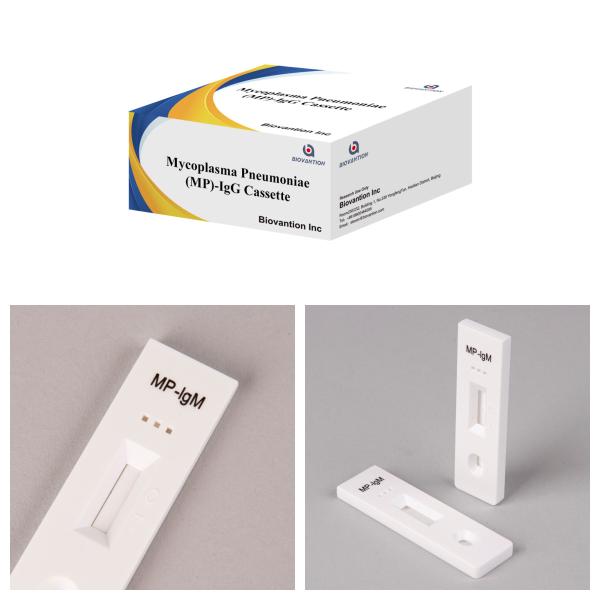Diagnostic Tools For Detecting Lung Bacteria Mycoplasma Pneumoniae MP-IgM Rapid Test