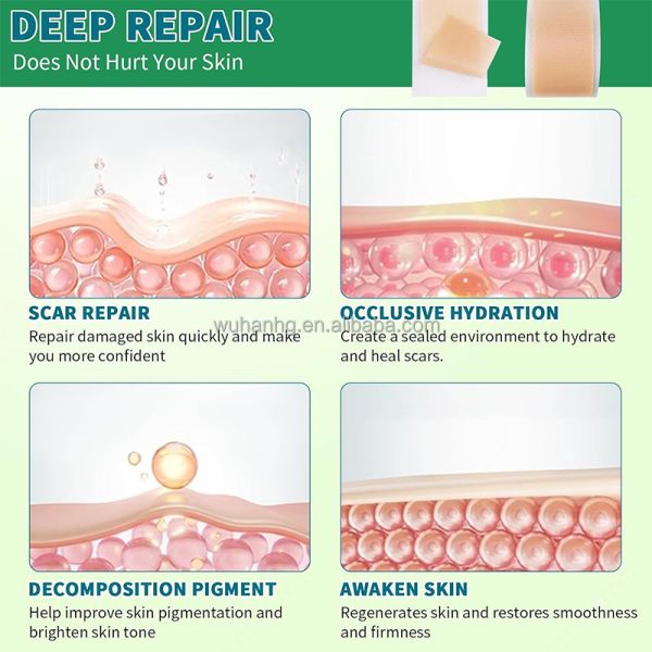 10cm width Self Adhesive Silicone Scar Removal Patch Hypoallergenic Scar Removal Tape