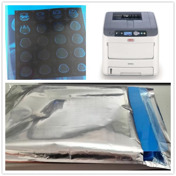 Водоустойчивый медицинский сухой фильм кс Рэй цифров фильма воображения для принтера канона Эпсон