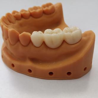 Fast-Sinter SHT Zirconia Block 90-Minute Turnaround 1500°C Protocol