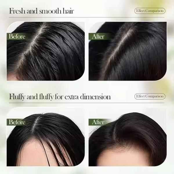 Controlo de óleo Shampoo anti caspa Anti-coceira Shampoo de limpeza profunda Shampoo capilar