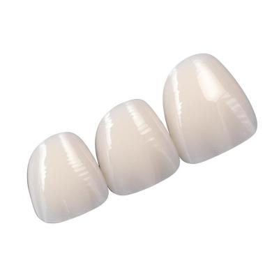 Affordable Feldspathic Dental Veneers in 16 Shades with 0.3-0.5mm Thickness for a Natural Smile