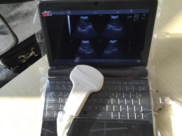 Transvaginal Handheld Ultrasound Scanner With 5 Kinds Of Probe Heads Exchangeable