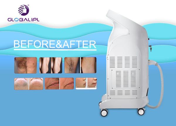 Sliding Screen Commercial Laser Hair Removal Machine 755nm 808nm 1064nm Triple Wavelength
