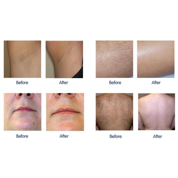 1200w диодная лазерная эпиляторная машина Салон 1-200J/CM2 многофункциональная косметическая машина