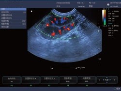 15'' LCD Display Portable Vet Ultrasound Machine Veterinary Use